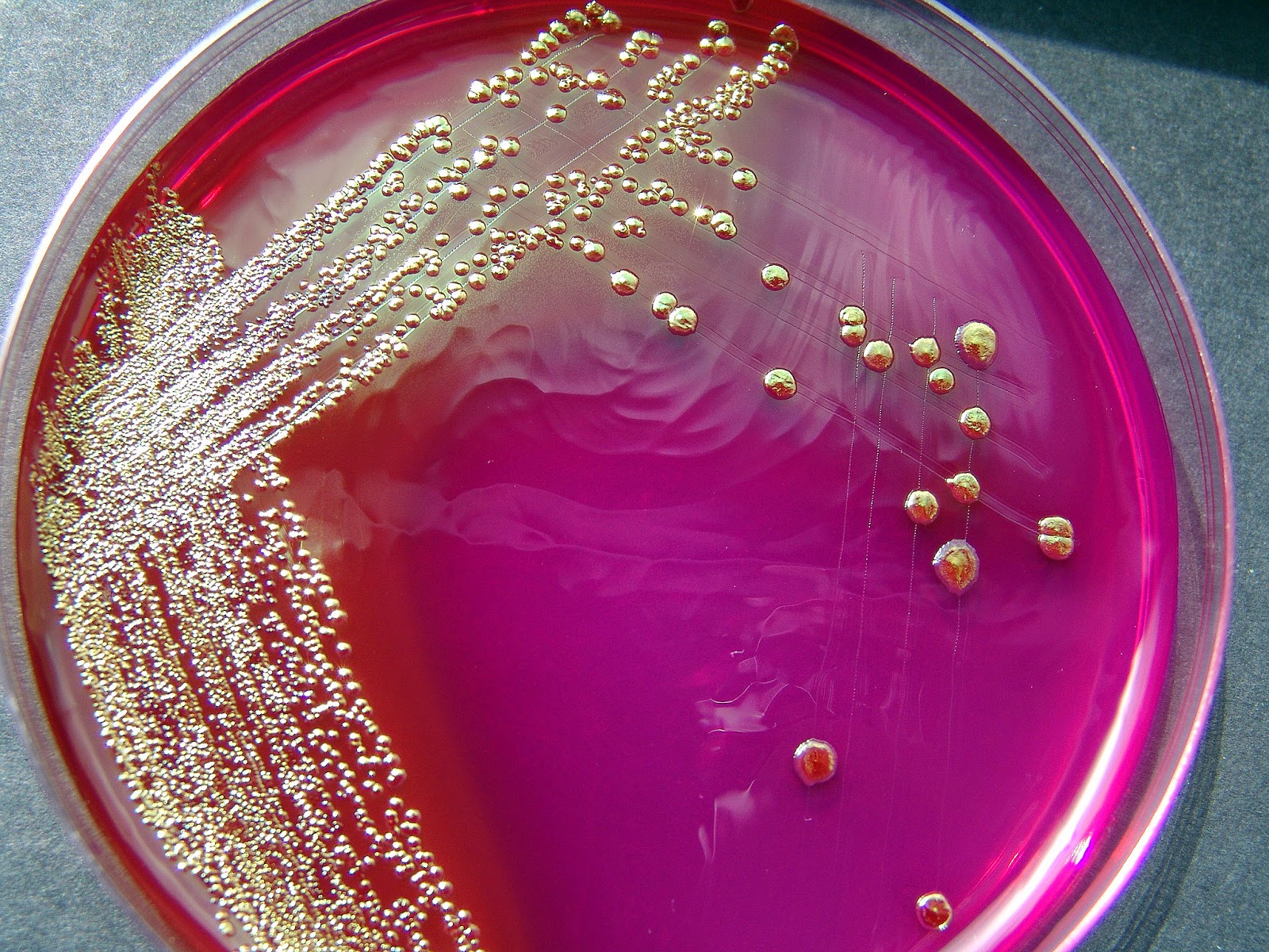 Microbiology E Coli Plate - HD Wallpaper 