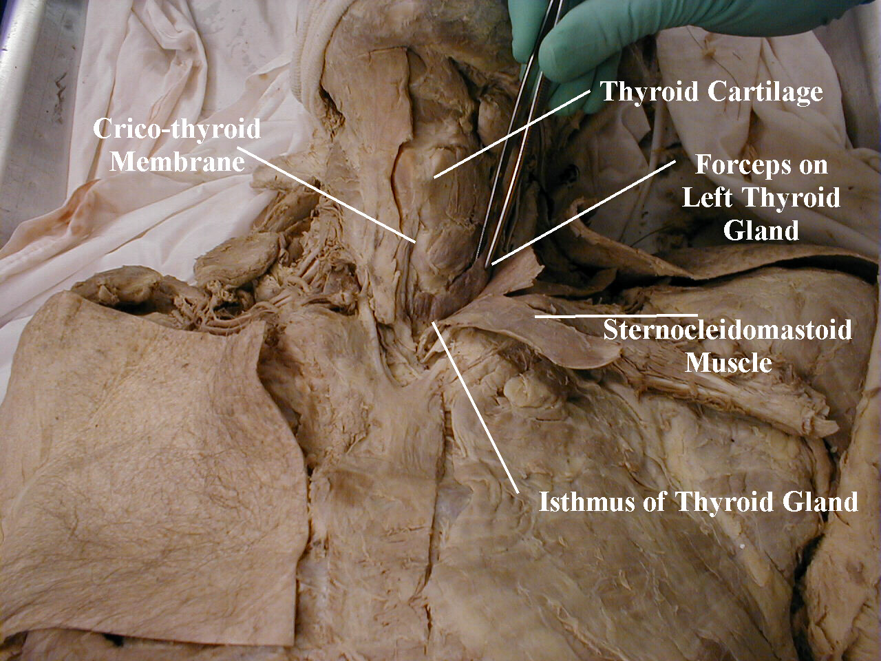Thyroid Anatomy - Thyroid Gland Gross Anatomy - HD Wallpaper 